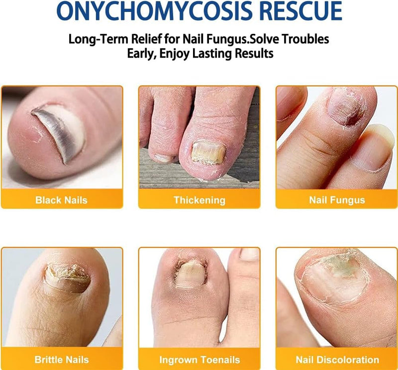 Fungal Nail Patches, 128 PCS Fungal Nail Treatment, Nail Fungus Treatment for Toenail, Fungal Toenail Treatment 8 Hour Nighttime Renewal Nail Fungus Treatment for Toenail