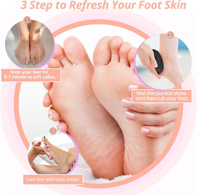 Pumice Foot Stone 1 Pcs - Pedicure Scrubber - Foot File and Callus Remover for Skin Exfoliation