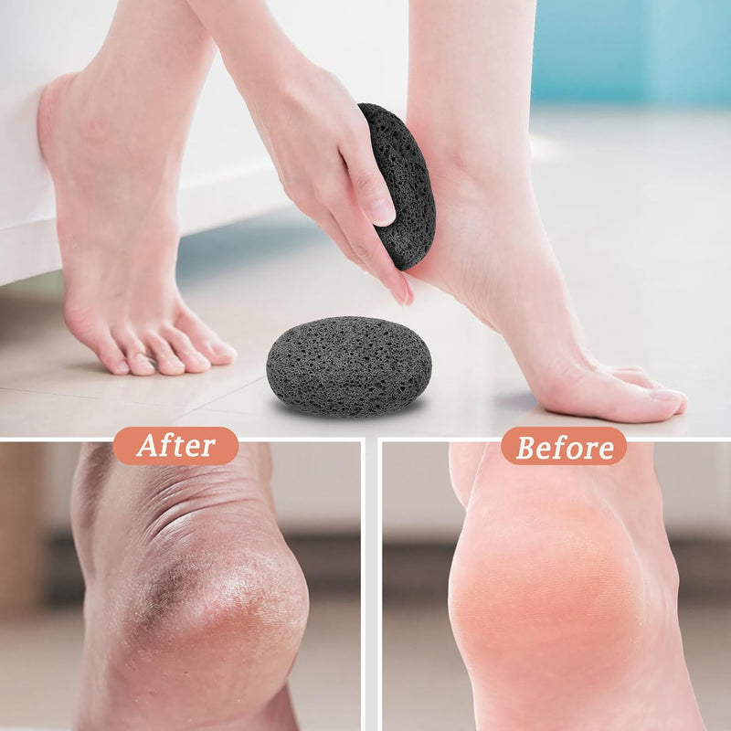Pumice Foot Stone 1 Pcs - Pedicure Scrubber - Foot File and Callus Remover for Skin Exfoliation