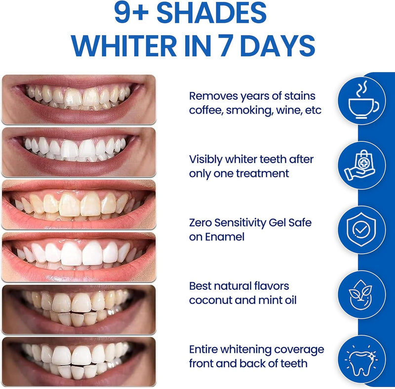 Teeth Whitening Strips- Mint Flavor, Zero Sensitivity, Enamel Safe, Dentist Formulated,Teeth Whitener Strips, White Teeth, Tooth Whitening Strip, Smile Teeth Whitening (Mint)