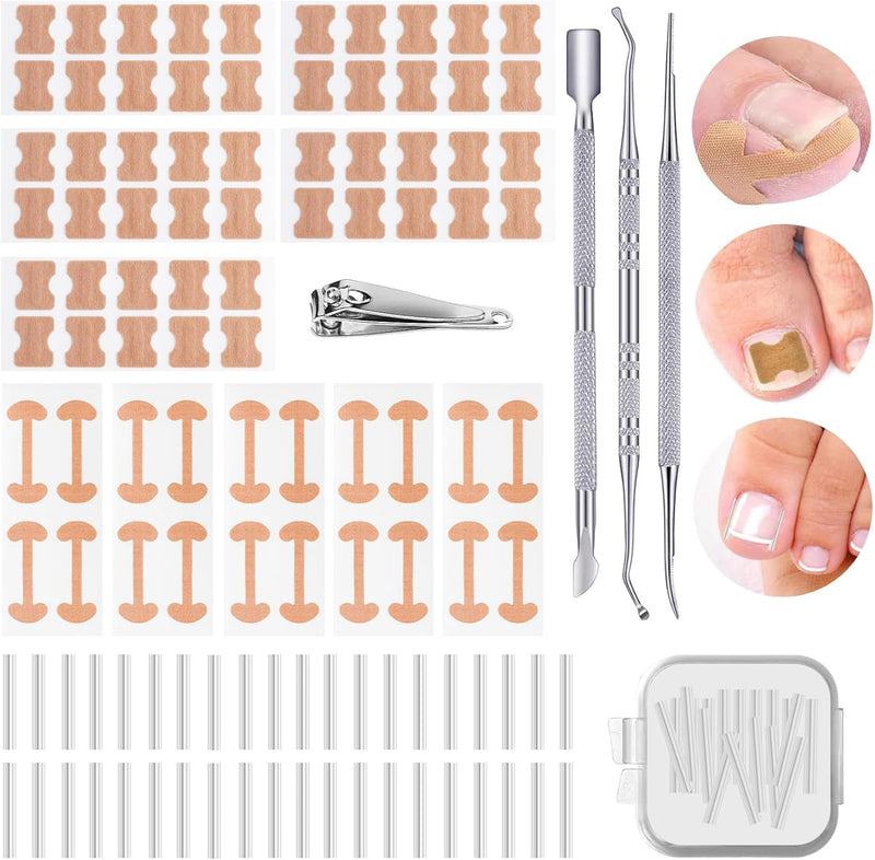 114 Pcs Ingrown Toenail Treatment Corrector, Ingrown Toenail Tool with Nail Clippers Ingrown Toenail File and Lifter, Ingrowing Toenail Treatment Kit, Pedicure Tools for Caring for Toes