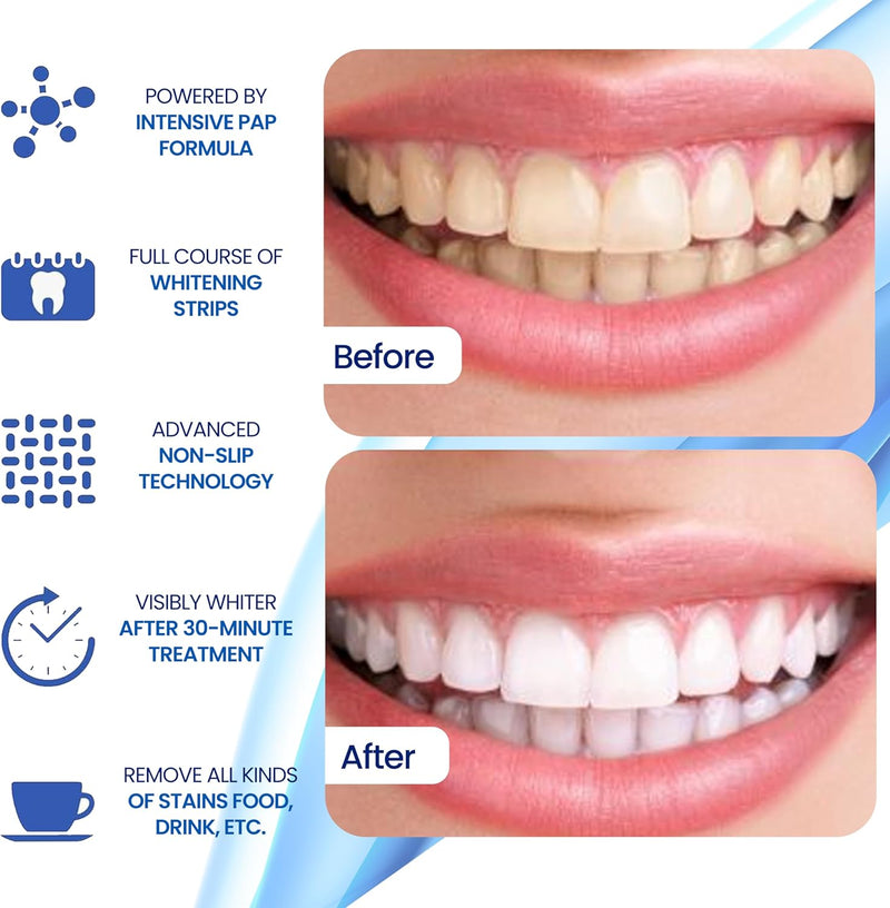 Teeth Whitening Strips- Mint Flavor, Zero Sensitivity, Enamel Safe, Dentist Formulated,Teeth Whitener Strips, White Teeth, Tooth Whitening Strip, Smile Teeth Whitening (Mint)