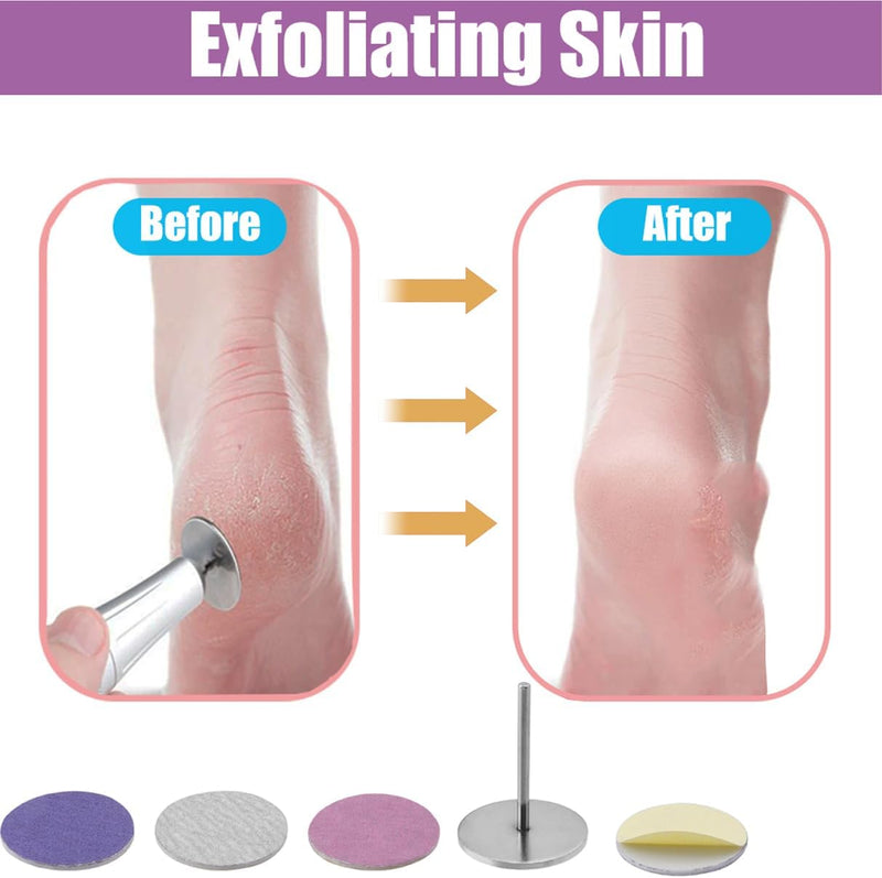 Sandpaper Callus Remover Pads, 60Pcs Replacement Feet Sandpaper Discs with 3/32 Inch Drill Bit for Professional Pedicure Rotary Tool Sand Paper Foot File for Electric Callus Dead Skin Remover
