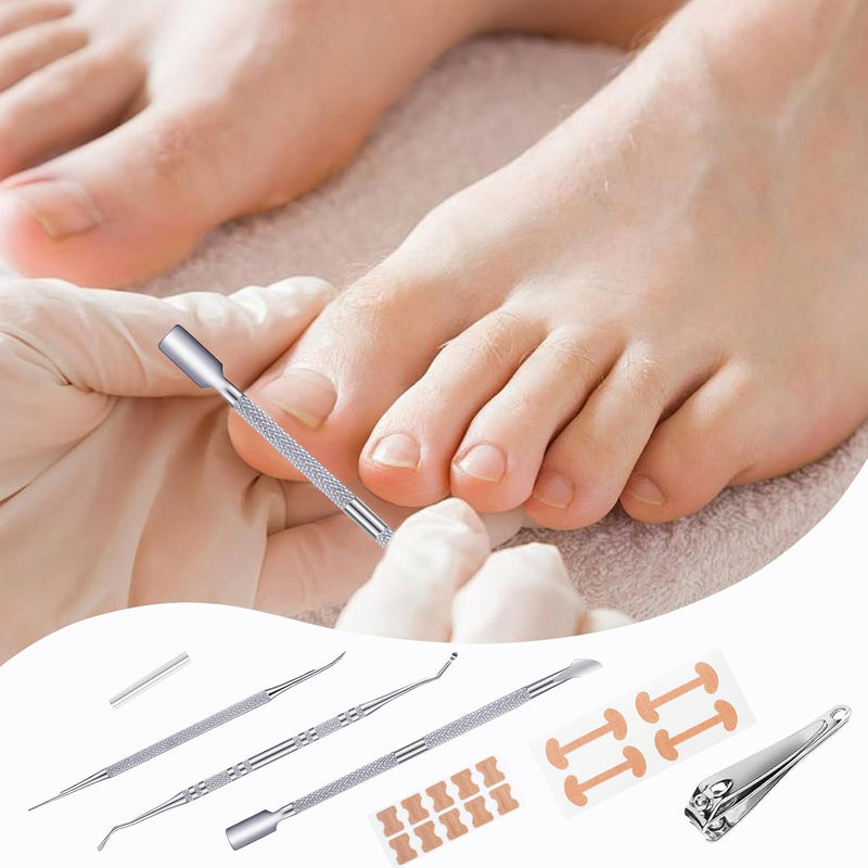 114 Pcs Ingrown Toenail Treatment Corrector, Ingrown Toenail Tool with Nail Clippers Ingrown Toenail File and Lifter, Ingrowing Toenail Treatment Kit, Pedicure Tools for Caring for Toes
